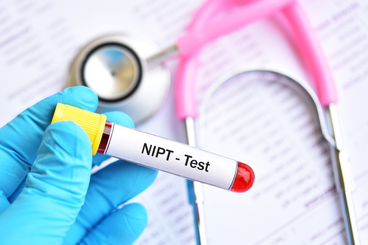 Blood sample for NIPT test